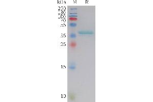 Human LEP Protein, hFc Tag on SDS-PAGE under reducing condition.