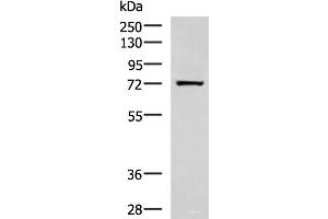 Western blot analysis of Human fetal liver tissue lysate using SHTN1 Polyclonal Antibody at dilution of 1:600 (Shootin-1 (SHTN1) anticorps)