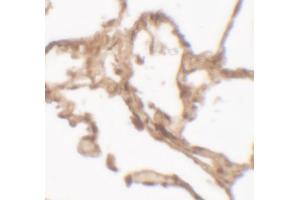 Immunohistochemistry (IHC) image for anti-Arylsulfatase B (ARSB) (C-Term) antibody (ABIN2457880) (Arylsulfatase B anticorps  (C-Term))