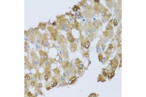 Immunohistochemistry of paraffin-embedded human liver injury using BNIP3 antibody (ABIN5973321) at dilution of 1/100 (40x lens). (BNIP3 anticorps)