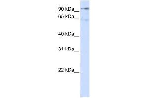 DLG7 antibody used at 1 ug/ml to detect target protein. (DLGAP5 anticorps  (N-Term))