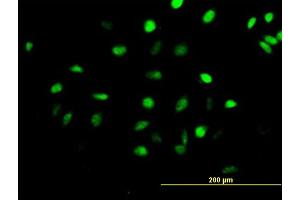 Immunofluorescence of purified MaxPab antibody to CENPH on HeLa cell.