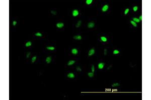 Immunofluorescence of purified MaxPab antibody to CENPH on HeLa cell. (CENPH anticorps  (AA 1-247))