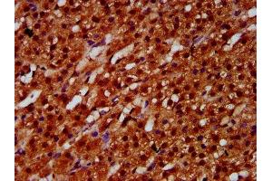 IHC image of ABIN7152082 diluted at 1:600 and staining in paraffin-embedded human adrenal gland tissue performed on a Leica BondTM system.
