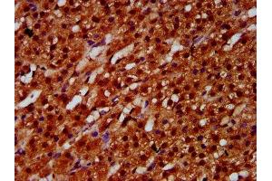 IHC image of ABIN7152082 diluted at 1:600 and staining in paraffin-embedded human adrenal gland tissue performed on a Leica BondTM system. (ETV5 anticorps  (AA 124-265))