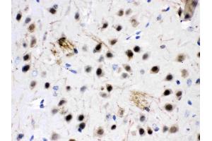 ZWINT was detected in paraffin-embedded sections of mouse brain tissues using rabbit anti- ZWINT Antigen Affinity purified polyclonal antibody (Catalog # ) at 1 µg/mL. (ZWINT anticorps  (AA 29-249))