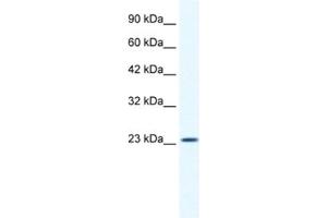 Western Blotting (WB) image for anti-Potassium Channel Tetramerisation Domain Containing 11 (KCTD11) antibody (ABIN2461421) (KCTD11 anticorps)