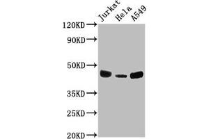 Western Blot Positive WB detected in: Jurkat whole cell lysate, Hela whole cell lysate, A549 whole cell lysate All lanes: HLA-C antibody at 1:2000 Secondary Goat polyclonal to rabbit IgG at 1/50000 dilution Predicted band size: 41 kDa Observed band size: 41 kDa (HLA-C anticorps  (AA 25-308))