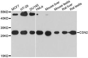 Western blot analysis of extracts of various cell lines, using CSN2 antibody. (CSN2 anticorps)