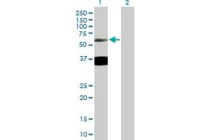 Western Blot analysis of TTBK2 expression in transfected 293T cell line by TTBK2 MaxPab polyclonal antibody. (TTBK2 anticorps  (AA 1-478))