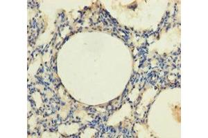 Immunohistochemistry of paraffin-embedded human lung tissue using ABIN7172870 at dilution of 1:100 (TRPM8 anticorps  (AA 1-192))