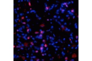 Immunostaining of fibrotic mouse lung tissue showing specific staining of collagen I  molecules (red) that are still associated with the cells in which they were synthesized. (COL1A1 anticorps)