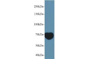 Detection of MIB2 in Mouse Serum using Polyclonal Antibody to Mindbomb Homolog 2 (MIB2)