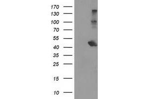 Western Blotting (WB) image for anti-Aryl Hydrocarbon Receptor Interacting Protein-Like 1 (AIPL1) antibody (ABIN1496509)