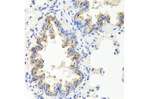 Immunohistochemistry of paraffin-embedded rat lung using SHH antibody (ABIN5975790) at dilution of 1/100 (40x lens). (Sonic Hedgehog anticorps)