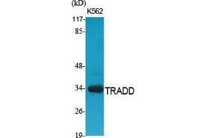 Western Blot (WB) analysis of specific cells using TRADD Polyclonal Antibody.