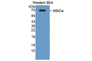Figure. (DcR1 anticorps  (AA 32-244))