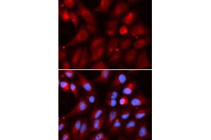Immunofluorescence analysis of U2OS cells using PSMB2 antibody.