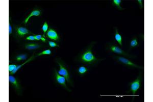 Immunofluorescence of purified MaxPab antibody to SACM1L on HeLa cell. (SACM1L anticorps  (AA 1-587))