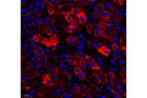 Immunofluorescence of paraffin embedded human liver using RBP (ABIN7075409) at dilution of 1: 650 (400x lens)