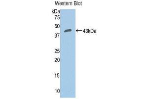 Western Blotting (WB) image for anti-Complement Factor B (CFB) (AA 35-160) antibody (ABIN3205634) (Complement Factor B anticorps  (AA 35-160))