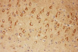 Anti-CNTF Picoband antibody,  IHC(P): Rat Brain Tissue