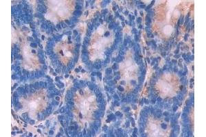 Detection of NOSTRIN in Rat Small intestine Tissue using Polyclonal Antibody to Nitric Oxide Synthase Trafficker (NOSTRIN)