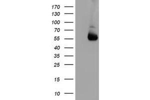Western Blotting (WB) image for anti-Asparagine-Linked Glycosylation 2, alpha-1,3-Mannosyltransferase Homolog (ALG2) antibody (ABIN1496609) (ALG2 anticorps)