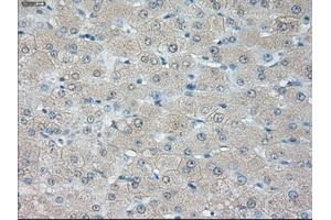 Immunohistochemical staining of paraffin-embedded liver tissue using anti-HSD17B10 mouse monoclonal antibody. (HSD17B10 anticorps)