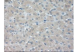 Immunohistochemical staining of paraffin-embedded liver tissue using anti-HSD17B10 mouse monoclonal antibody. (HSD17B10 anticorps)