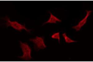 ABIN6267260 staining SK-OV3 by IF/ICC. (EGFR anticorps  (pTyr1016))