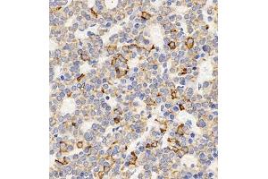 Immunohistochemistry of paraffin embedded rat hypophysis using TSH (ABIN7075906) at dilution of 1:400 (400x lens) (TSHB anticorps)