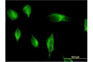 Immunofluorescence of monoclonal antibody to PIK3C2A on HeLa cell.