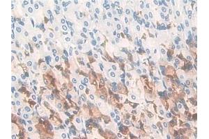 Detection of GIF in Rat Stomach Tissue using Polyclonal Antibody to Gastric Intrinsic Factor (GIF)