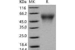 Western Blotting (WB) image for Carboxylesterase 2E (CES2E) (Active) protein (His tag) (ABIN7194593)