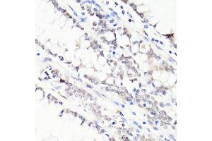 Immunohistochemistry of paraffin-embedded human colon using FKBP5 antibody.