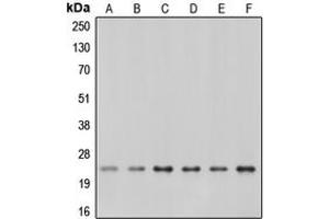 Western blot analysis of Caveolin 1 expression in A549 (A), A431 (B), NIH3T3 (C), mouse kidney (D), rat kidney (E), rat heart (F) whole cell lysates. (Caveolin-1 anticorps  (C-Term))