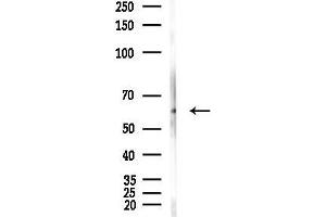 anti-Pyruvate Kinase M1/2 (PKM) (Internal Region) antibody