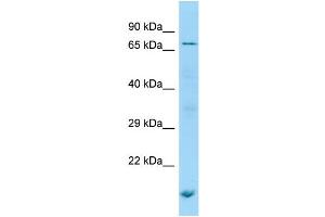 WB Suggested Anti-POF1B Antibody Titration: 1. (POF1B anticorps  (N-Term))