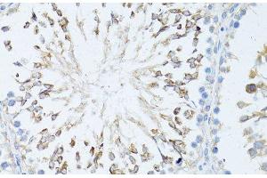 Immunohistochemistry of paraffin-embedded Rat testis using TEFM Polyclonal Antibody at dilution of 1:100 (40x lens). (TEFM anticorps)