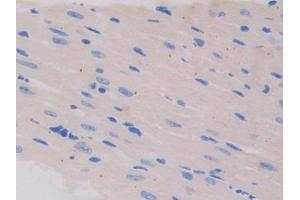 Used in DAB staining on fromalin fixed paraffin- embedded testis tissue (IL13 Receptor alpha 1 anticorps  (AA 201-360))