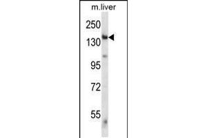 Western blot analysis in mouse liver tissue lysates (35ug/lane). (GCN2 anticorps  (C-Term))