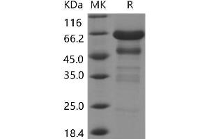 Western Blotting (WB) image for Insulin-Like Growth Factor Binding Protein 2, 36kDa (IGFBP2) protein (Fc Tag) (ABIN7196214)