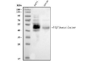 Western blot analysis of Tissue Factor using anti-Tissue Factor antibody (ABIN3042382).