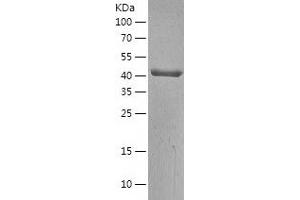 Western Blotting (WB) image for Acetyl-CoA Acetyltransferase 2 (ACAT2) (AA 1-397) protein (His-IF2DI Tag) (ABIN7121641)