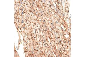 Immunohistochemistry of paraffin-embedded rat heart using Caveolin-3 Rabbit mAb (ABIN7266157) at dilution of 1:100 (40x lens). (Caveolin 3 anticorps)