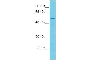 Host: Rabbit Target Name: CCDC41 Sample Type: Jurkat Whole Cell lysates Antibody Dilution: 1. (CCDC41 anticorps  (C-Term))