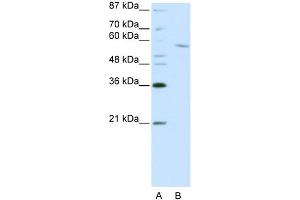 WB Suggested Anti-RCOR1 Antibody Titration:  0. (CoREST anticorps  (C-Term))