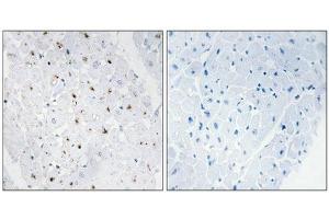 Immunohistochemical analysis of paraffin-embedded human heart tissue, using Bloom Syndrome Protein (Phospho-Thr99) antibody (left)or the same antibody preincubated with blocking peptide (right). (BLM anticorps  (pThr99))