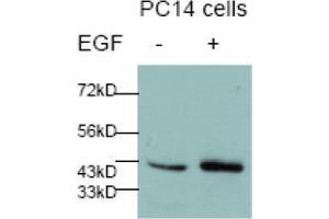 Image no. 2 for anti-Jun Proto-Oncogene (JUN) (pSer73) antibody (ABIN196613) (C-JUN anticorps  (pSer73))